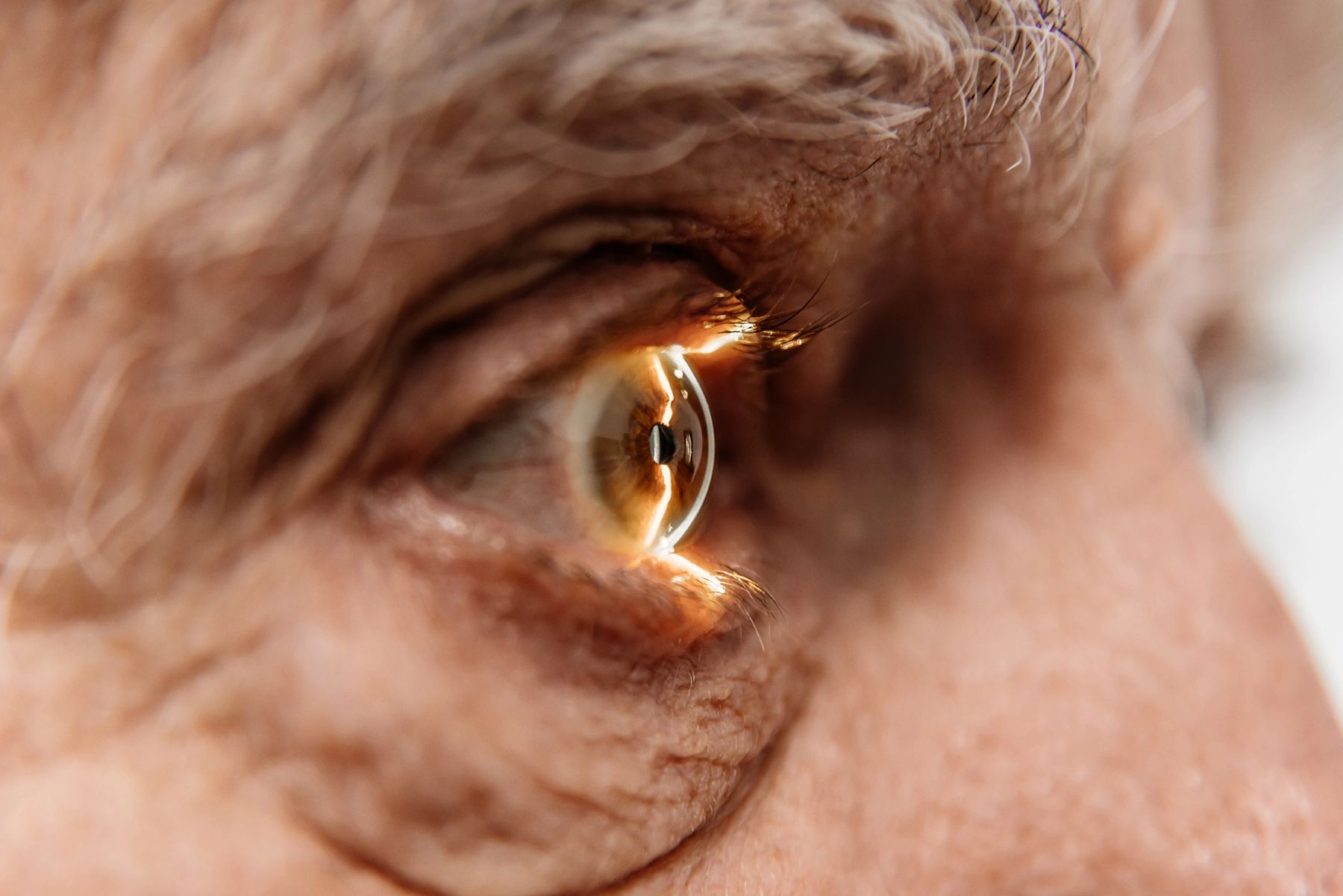 Dry eye care